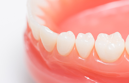 米子市新開・けやき歯科・入れ歯(義歯)